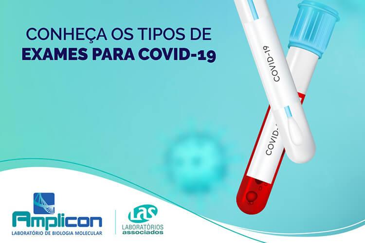 Demanda aumenta, e pedidos para exame RT-PCR para Covid em redes  particulares pode levar sete dias - 04/12/2020 - Equilíbrio e Saúde - Folha